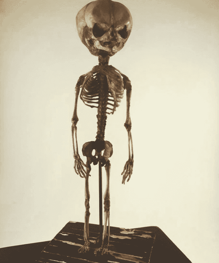 Squelette fœtal humain